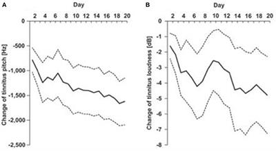 A State-of-Art Review of Digital Technologies for the Next Generation of Tinnitus Therapeutics